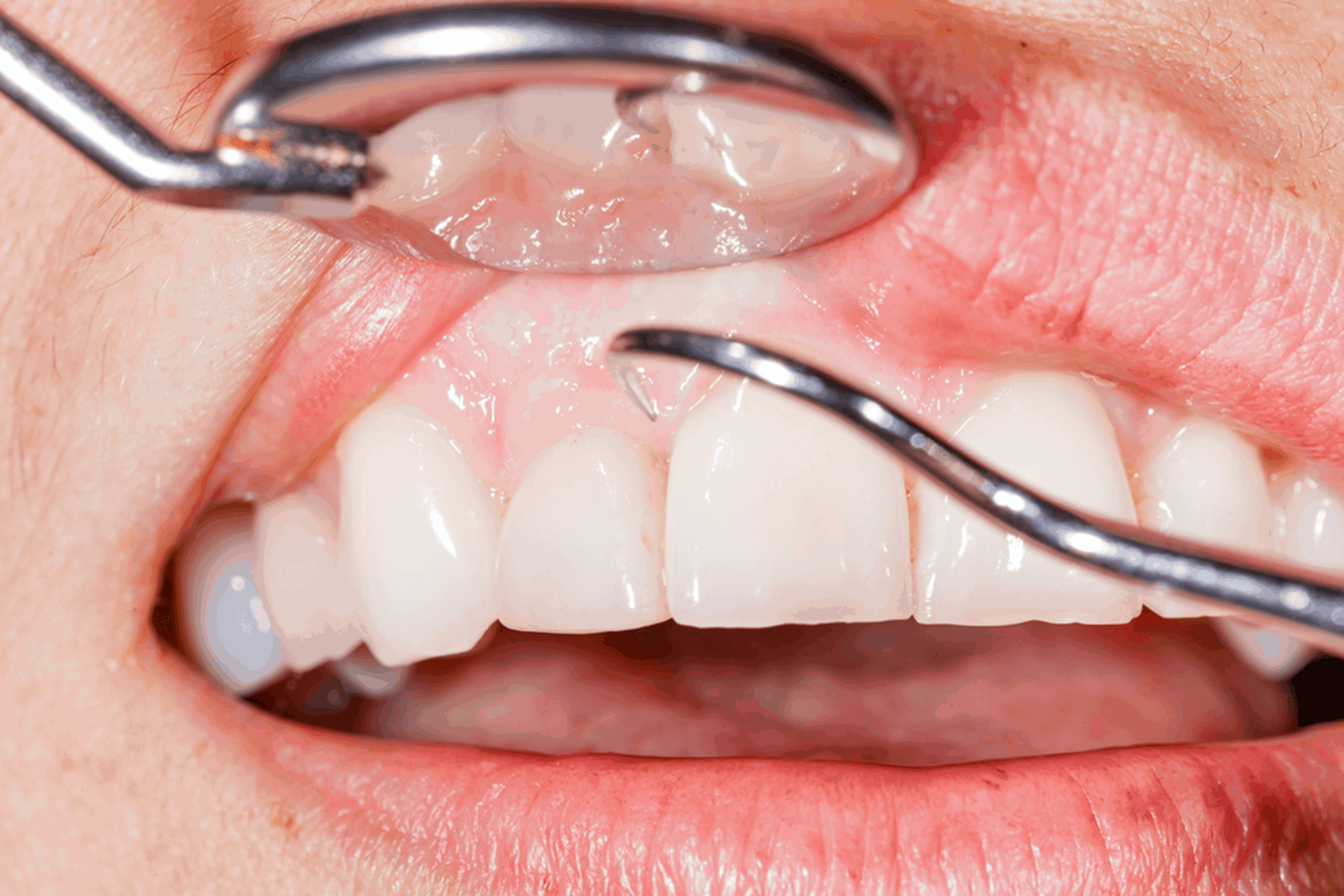 gum disease in mckenzie towne