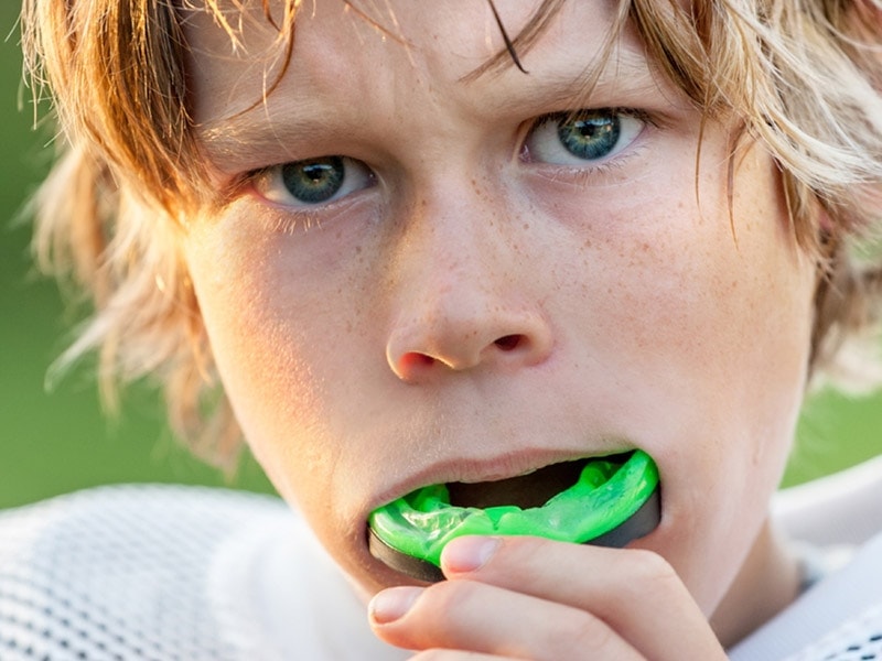 mouth guards in mckenzie towne