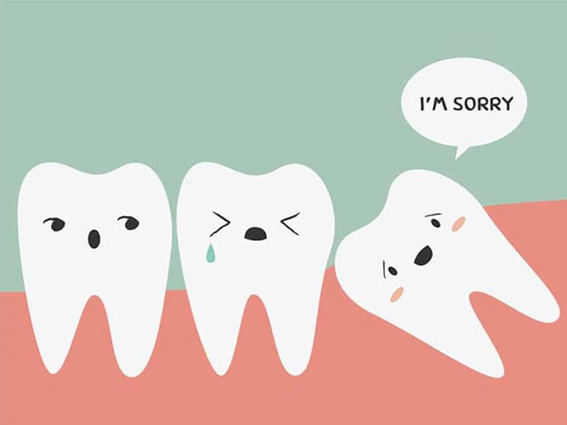 wisdom teeth extractions in mckenzie towne