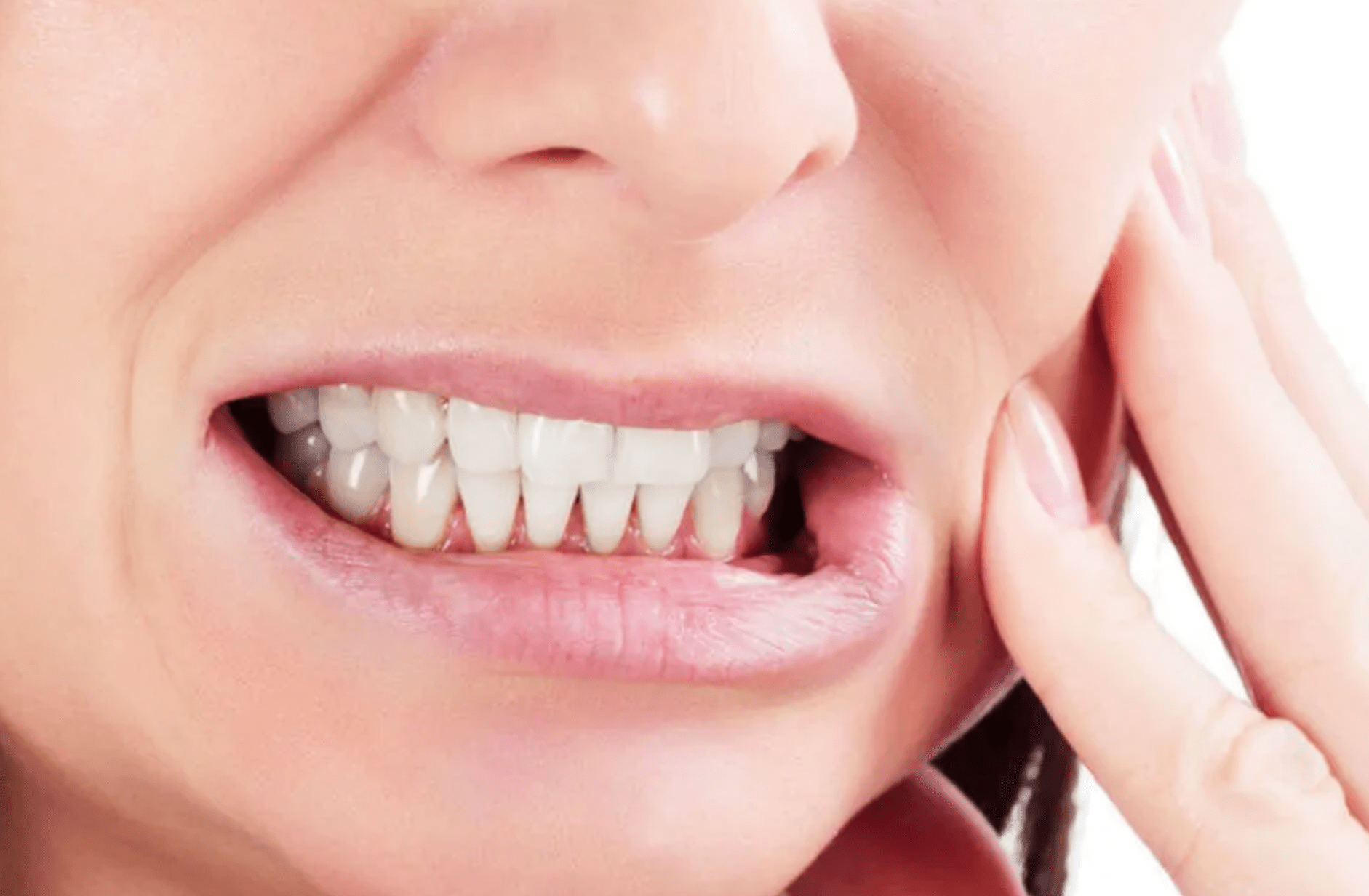 Teeth Grinding Bruxism