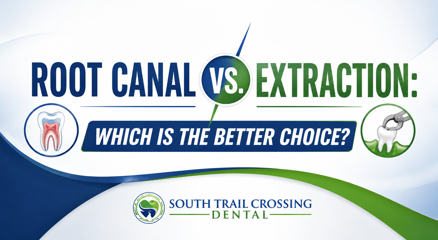 Root Canal vs. Extraction